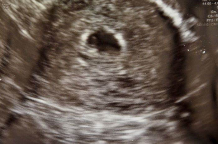 5 weeks with Olivia: First OB ultrasound