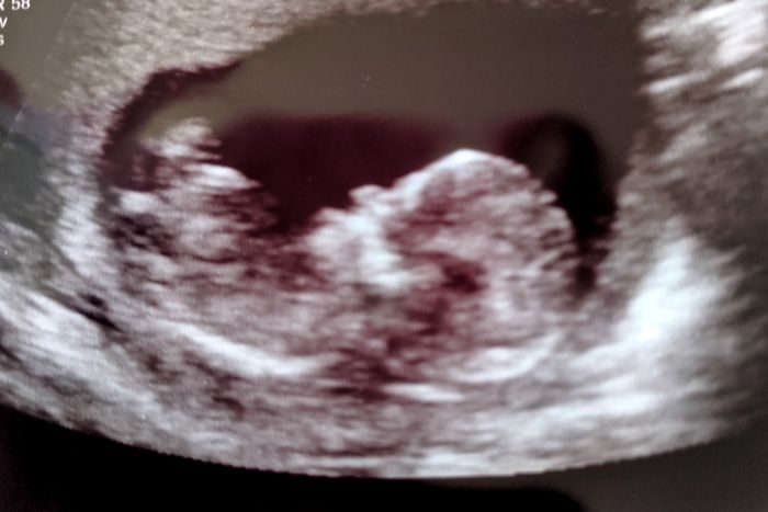 13 Weeks with Emelia: Things are settling down