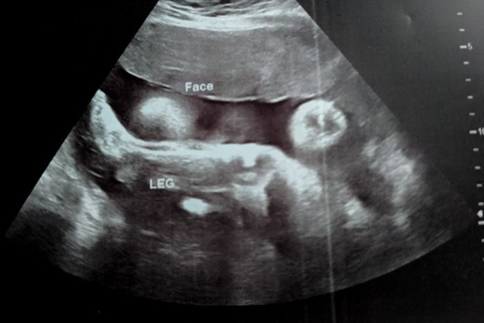 30 weeks with Emelia: I trained the toddler to give me foot rubs