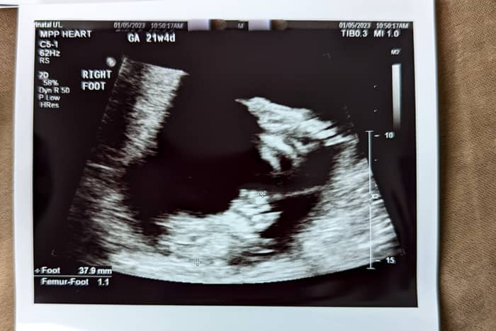 21 weeks with baby #3: Level 2 ultrasound results