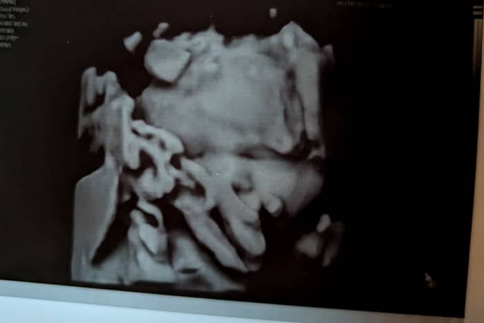 33 weeks with baby #3: We finally got a 3-D image of Pokemon and we talk induction